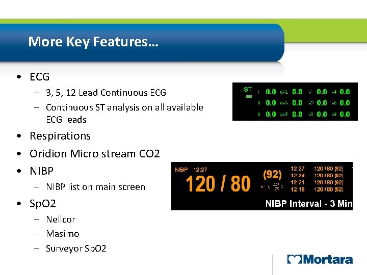 More Key Features… • ECG – 3, 5, 12 Lead Continuous ECG – Continuous