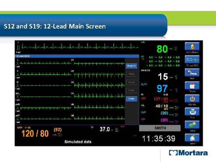 S 12 and S 19: 12 -Lead Main Screen Full Disclosure Window 