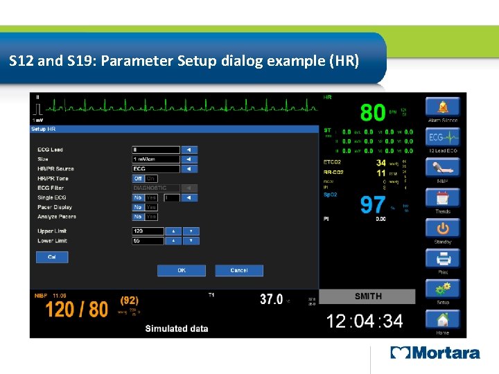 S 12 and S 19: Parameter Setup dialog example (HR) Full Disclosure Window 