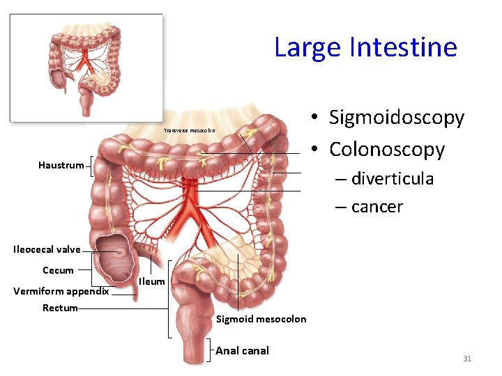 Large Intestine • Sigmoidoscopy • Colonoscopy Transverse mesocolon Haustrum – diverticula – cancer Ileocecal
