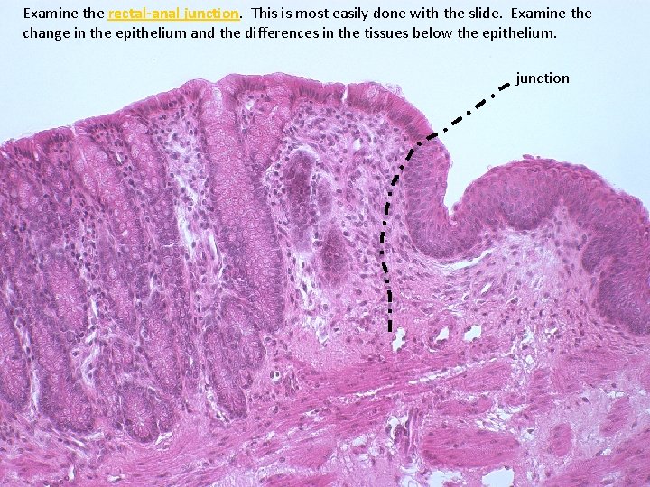 Examine the rectal-anal junction This is most easily done with the slide. Examine the