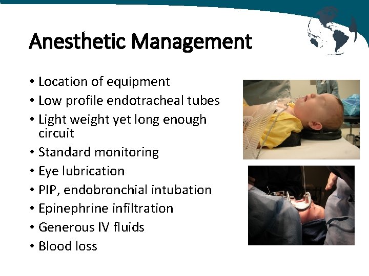 Anesthetic Management • Location of equipment • Low profile endotracheal tubes • Light weight