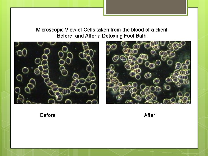 Microscopic View of Cells taken from the blood of a client Before and After