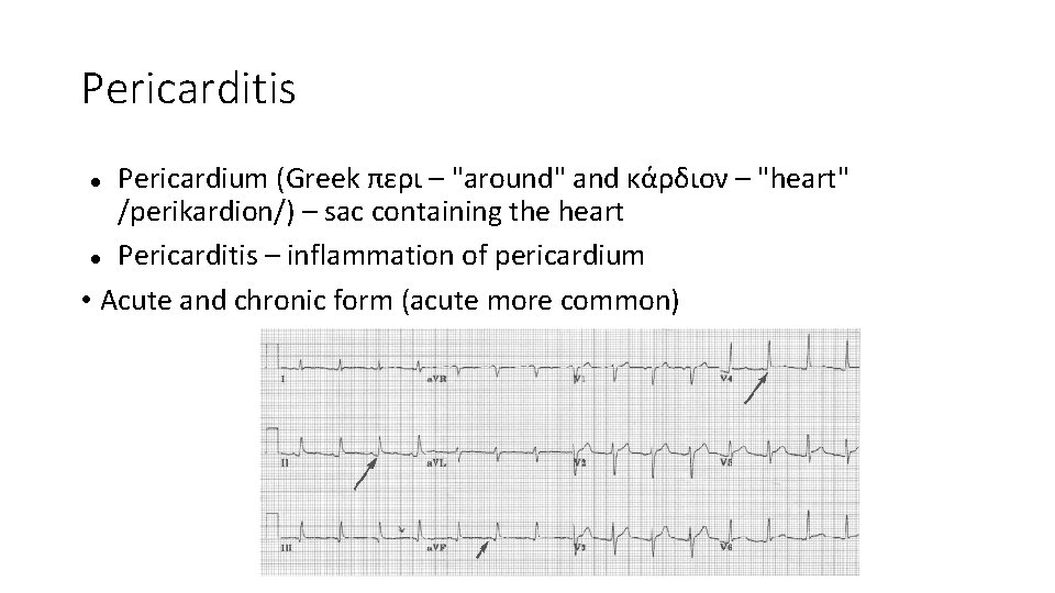 Pericarditis Pericardium (Greek περι – "around" and κάρδιον – "heart" /perikardion/) – sac containing