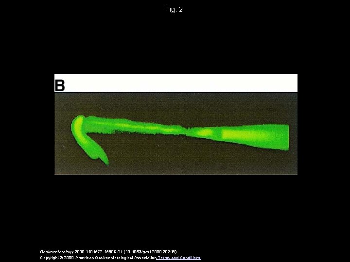 Fig. 2 Gastroenterology 2000 1191672 -1680 DOI: (10. 1053/gast. 2000. 20248) Copyright © 2000