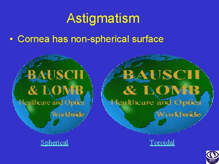 Astigmatism • Cornea has non-spherical surface Spherical Toroidal 