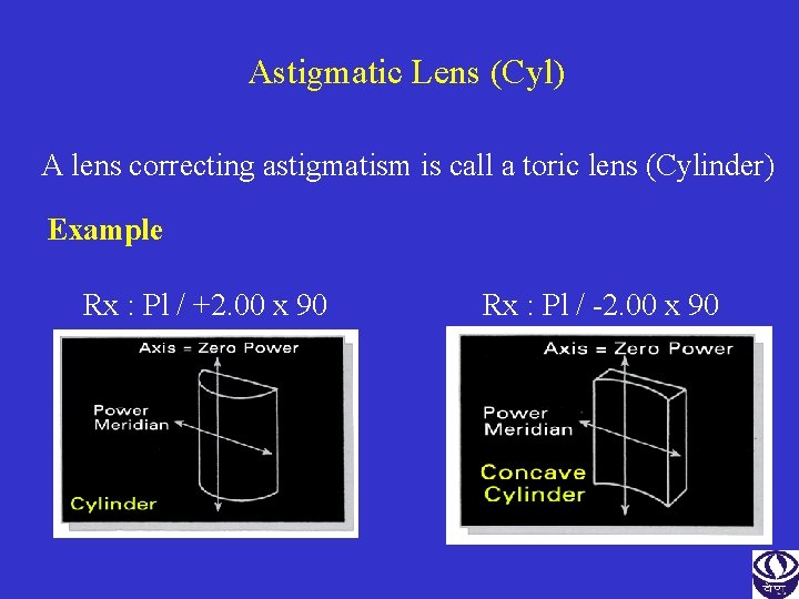 Astigmatic Lens (Cyl) A lens correcting astigmatism is call a toric lens (Cylinder) Example