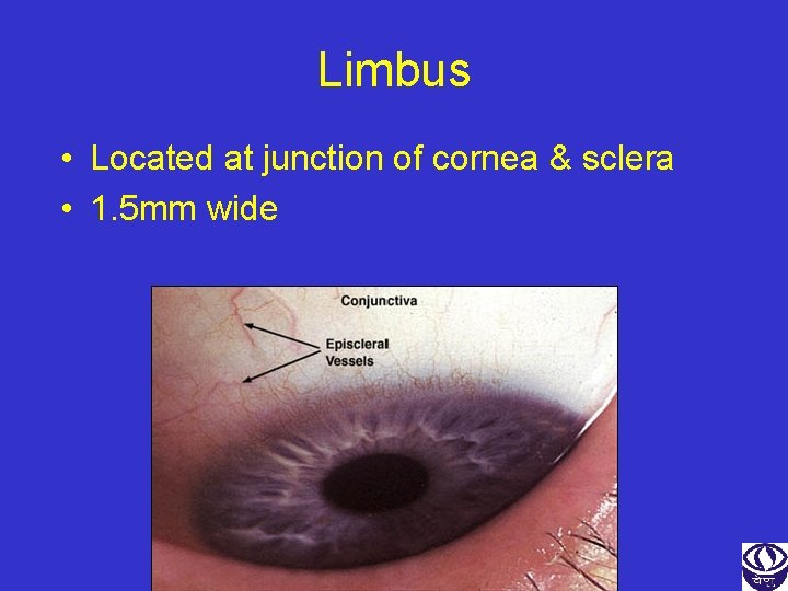 Limbus • Located at junction of cornea & sclera • 1. 5 mm wide