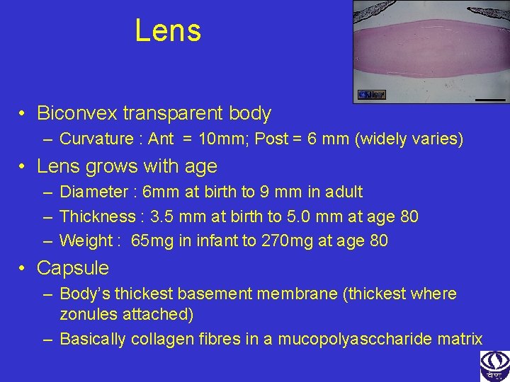 Lens • Biconvex transparent body – Curvature : Ant = 10 mm; Post =