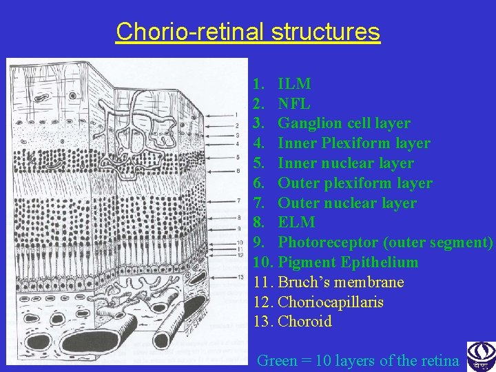 Chorio-retinal structures 1. ILM 2. NFL 3. Ganglion cell layer 4. Inner Plexiform layer