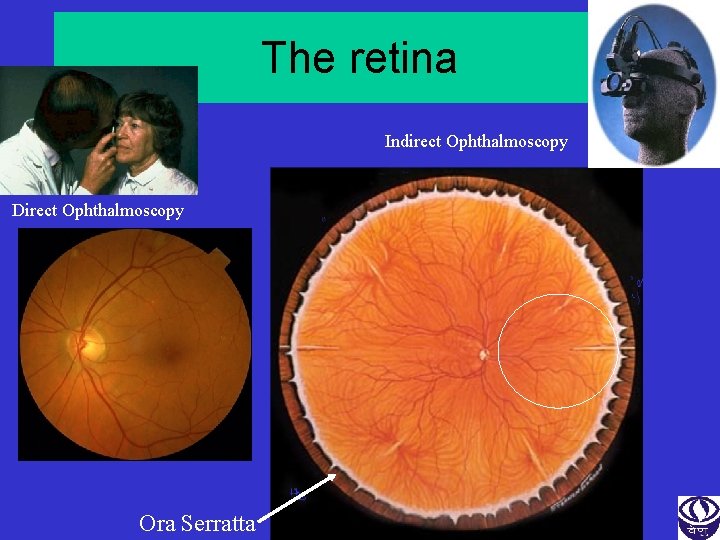 The retina Indirect Ophthalmoscopy Direct Ophthalmoscopy Ora Serratta 