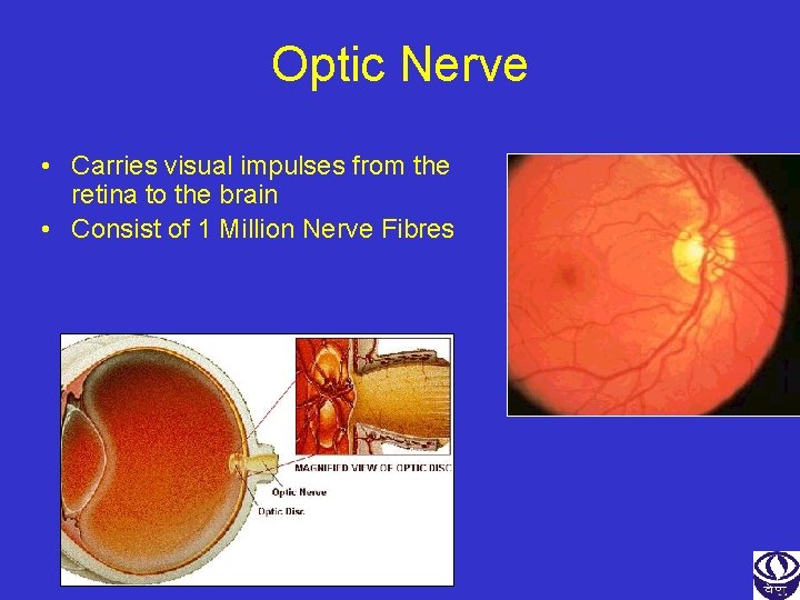 Optic Nerve • Carries visual impulses from the retina to the brain • Consist