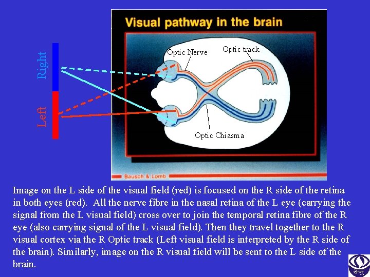 Right Optic track Left Optic Nerve Optic Chiasma Image on the L side of