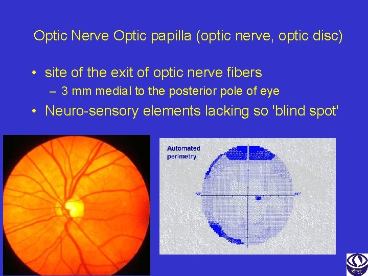 Optic Nerve Optic papilla (optic nerve, optic disc) • site of the exit of