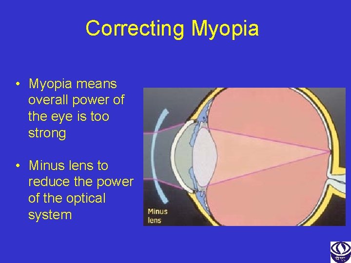 Correcting Myopia • Myopia means overall power of the eye is too strong •