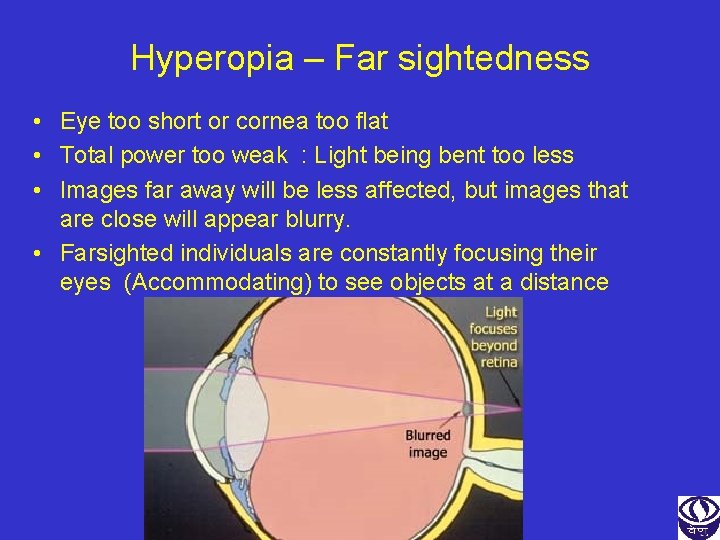 Hyperopia – Far sightedness • Eye too short or cornea too flat • Total