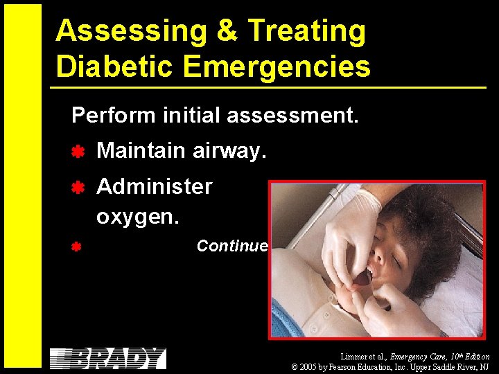 Assessing & Treating Diabetic Emergencies Perform initial assessment. Maintain airway. Administer oxygen. Continued… Limmer