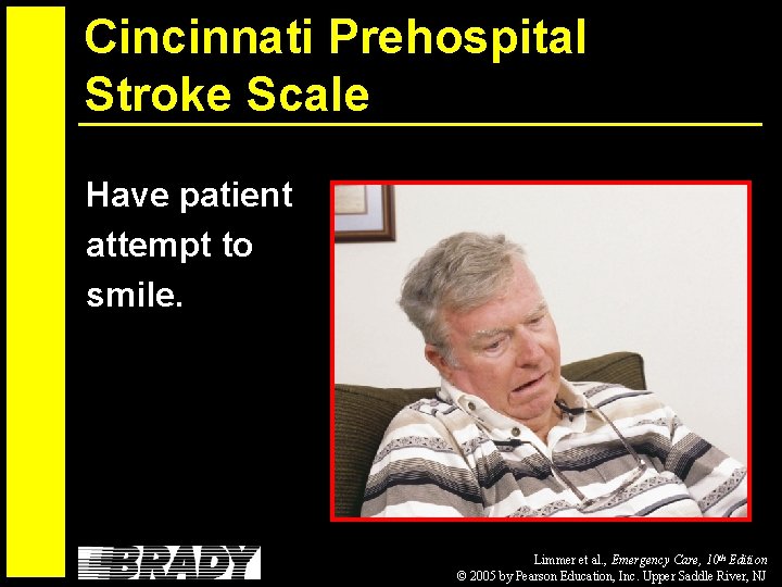 Cincinnati Prehospital Stroke Scale Have patient attempt to smile. Limmer et al. , Emergency