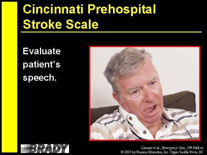 Cincinnati Prehospital Stroke Scale Evaluate patient’s speech. Limmer et al. , Emergency Care, 10