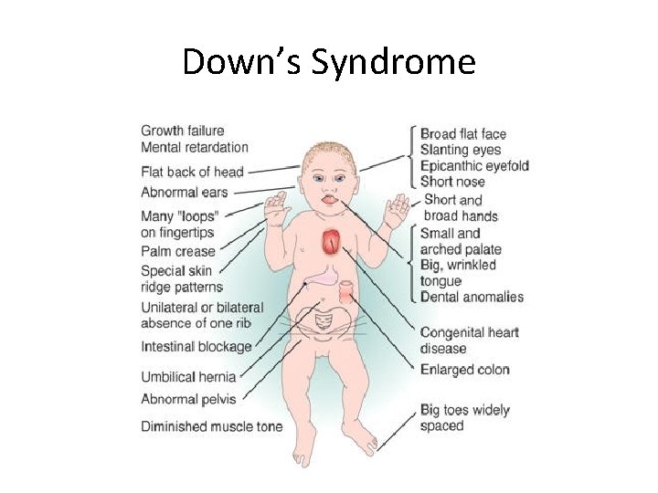 Down’s Syndrome 
