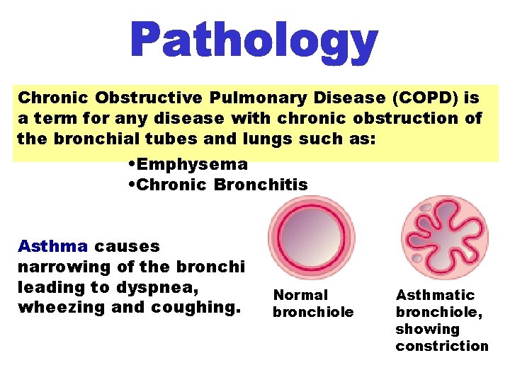 Chronic Obstructive Pulmonary Chronic Obstructive Disease Pulmonary Disease (COPD) is a term for any