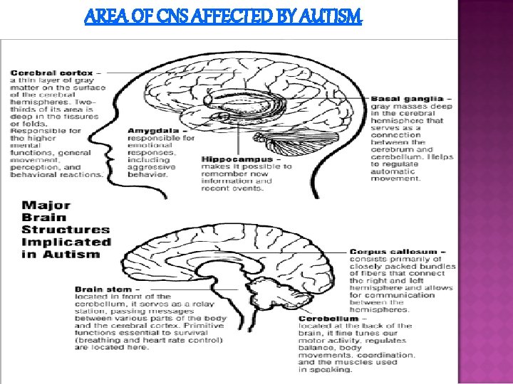 AREA OF CNS AFFECTED BY AUTISM 