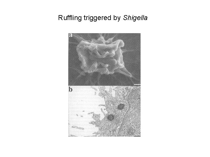 Ruffling triggered by Shigella 