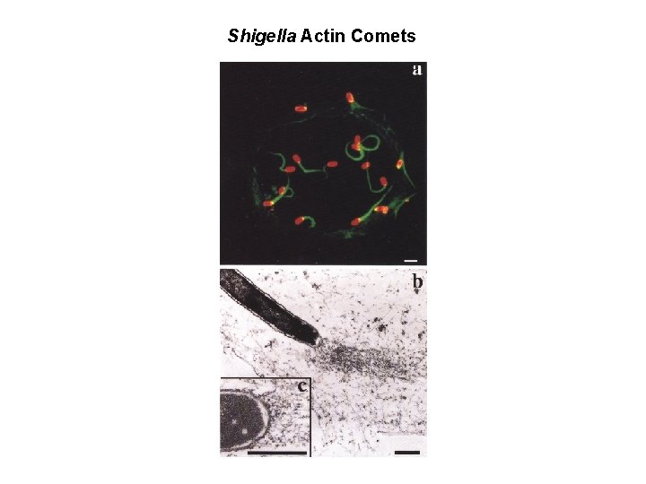 Shigella Actin Comets 