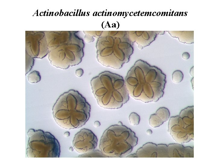 Actinobacillus actinomycetemcomitans (Aa) 