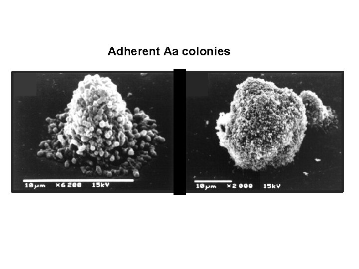 Adherent Aa colonies 