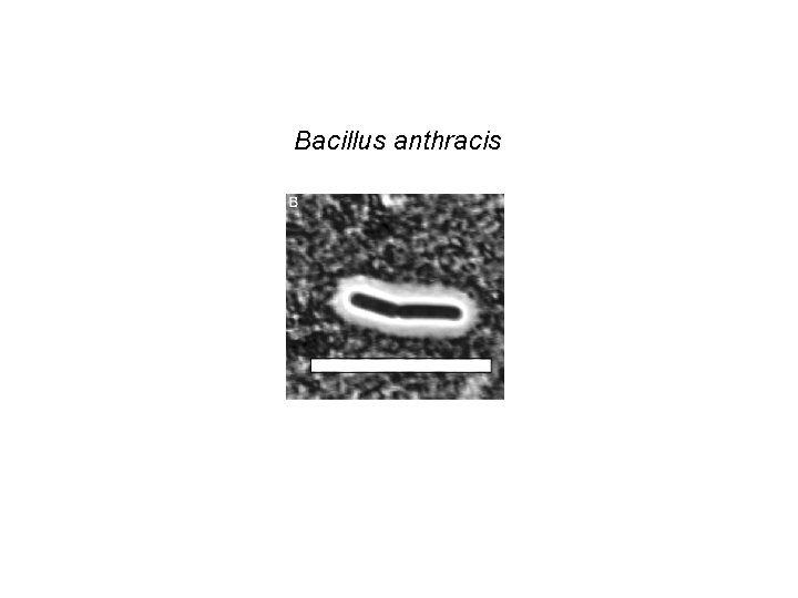 Fig. 3. B. cereus G 9241 capsule Bacillus anthracis Hoffmaster, Alex R. et al.