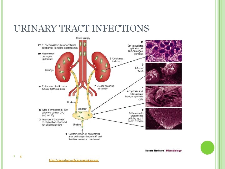 URINARY TRACT INFECTIONS / http: //urinarytract-infection-symptoms. com  URINARY TRACT INFECTIONS / http: //urinarytract-infection-symptoms. com