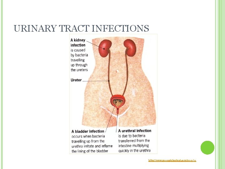URINARY TRACT INFECTIONS http: //www. 200 eastchestnut. com/2010/11  URINARY TRACT INFECTIONS http: //www. 200 eastchestnut. com/2010/11