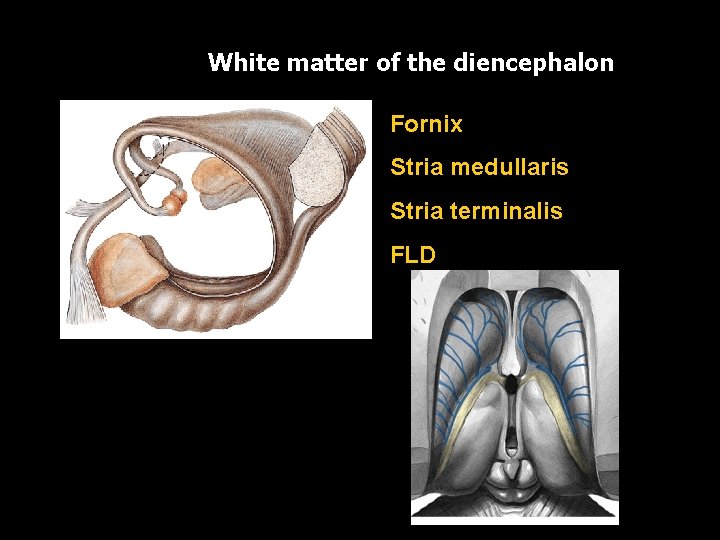 White matter of the diencephalon Fornix Stria medullaris Stria terminalis FLD 