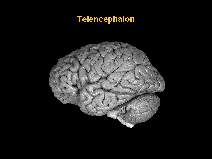 Telencephalon 