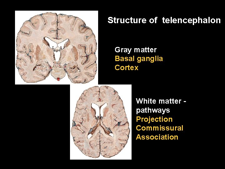 Structure of telencephalon Gray matter Basal ganglia Cortex White matter pathways Projection Commissural Association