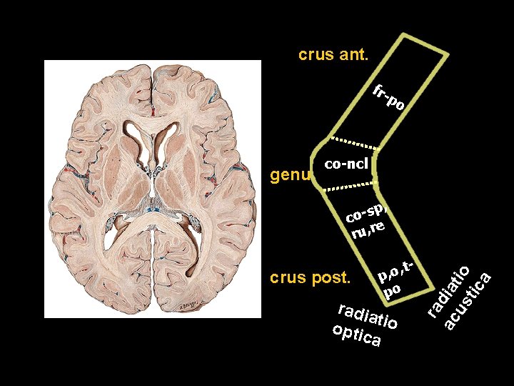 crus ant. fr- po genu co-ncl crus post. , to , p po radi