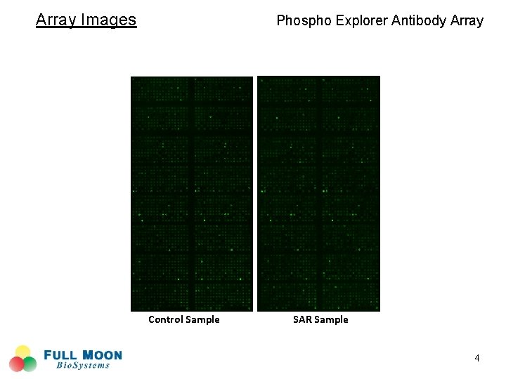 Array Images Phospho Explorer Antibody Array Control Sample SAR Sample 4 