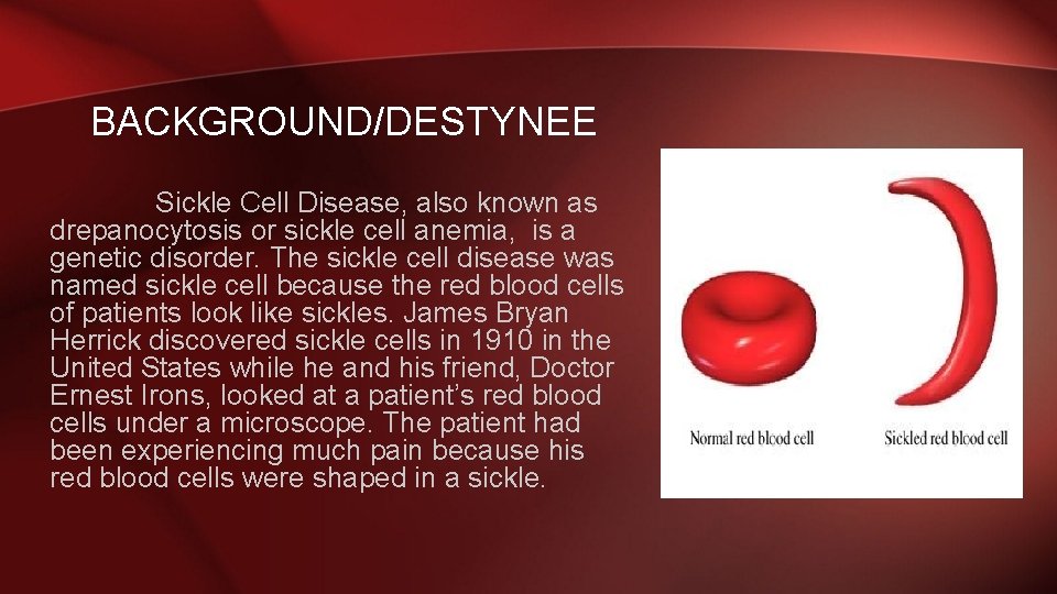 BACKGROUND/DESTYNEE Sickle Cell Disease, also known as drepanocytosis or sickle cell anemia, is a
