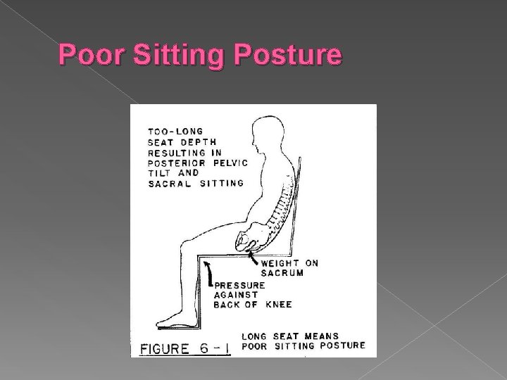 Poor Sitting Posture 