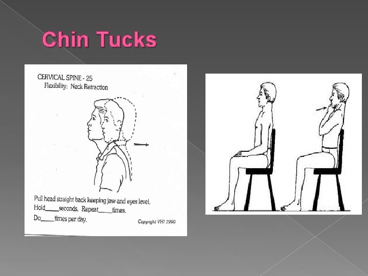 Chin Tucks 