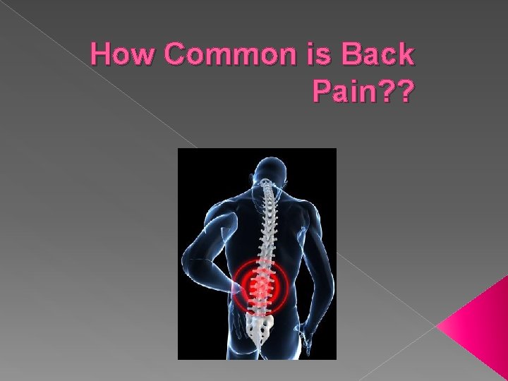 How Common is Back Pain? ? 