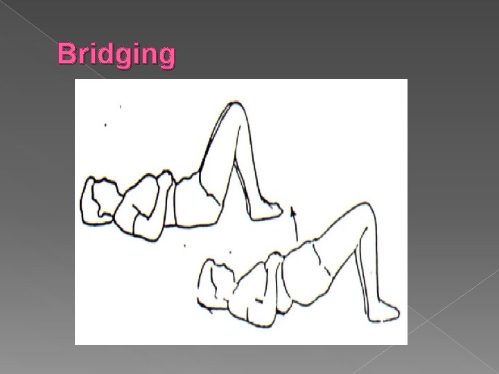 Bridging 