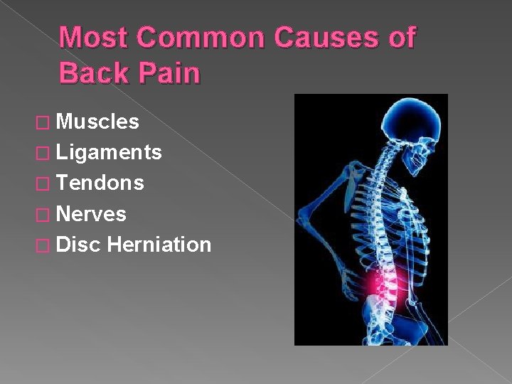 Most Common Causes of Back Pain � Muscles � Ligaments � Tendons � Nerves