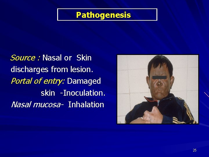 Pathogenesis Source : Nasal or Skin discharges from lesion. Portal of entry: Damaged skin