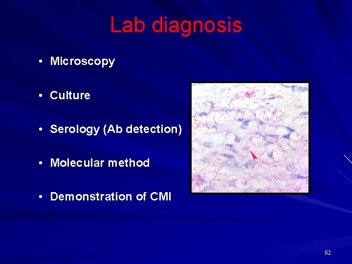 Lab diagnosis • Microscopy • Culture • Serology (Ab detection) • Molecular method •