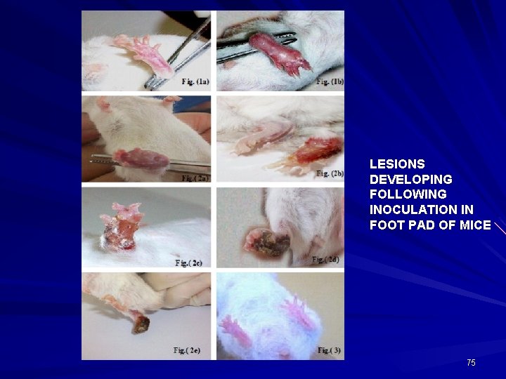 LESIONS DEVELOPING FOLLOWING INOCULATION IN FOOT PAD OF MICE 75 