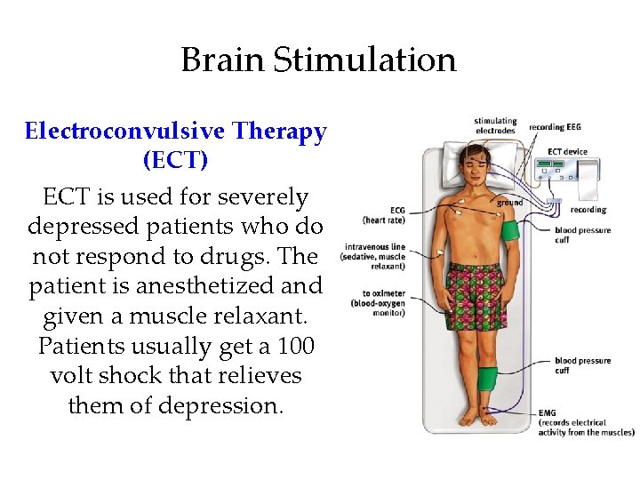 Brain Stimulation Electroconvulsive Therapy (ECT) ECT is used for severely depressed patients who do Brain Stimulation Electroconvulsive Therapy (ECT) ECT is used for severely depressed patients who do