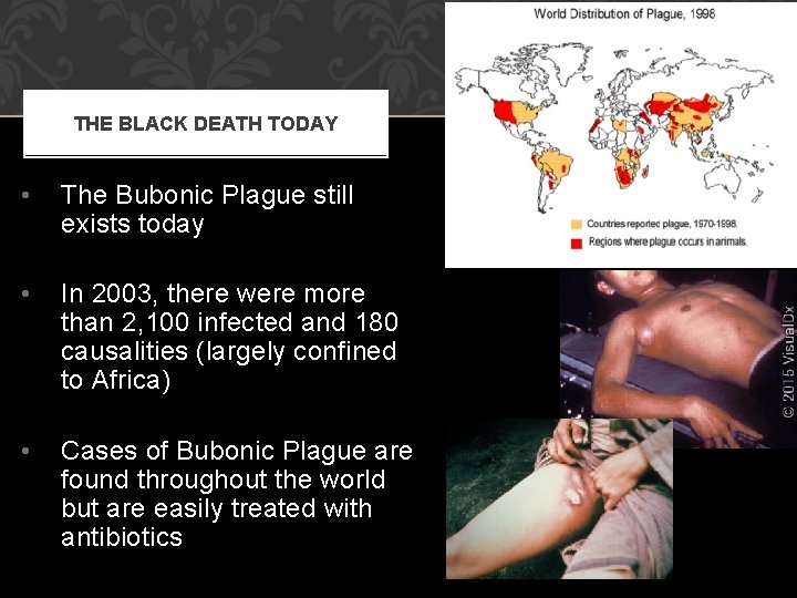 THE BLACK DEATH TODAY • The Bubonic Plague still exists today • In 2003,