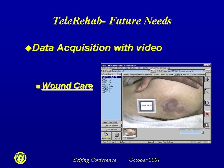 Tele. Rehab- Future Needs u. Data Acquisition with video n Wound Care Beijing Conference